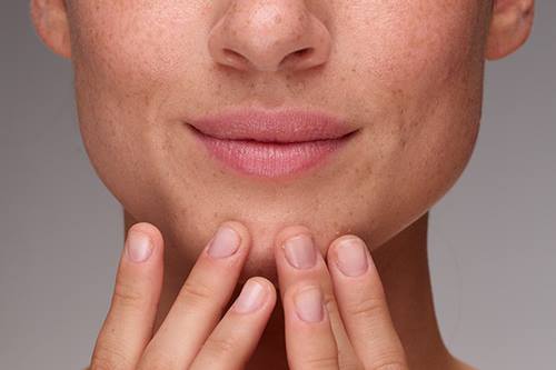 CeraVe-What-Skin-Type-Do-I-Have