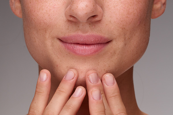 Tips on How You Must Choose Your Moisturizer According to Your Skin Type