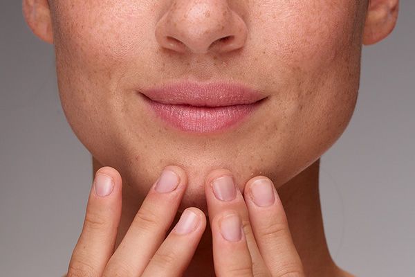 5 Different Types of Skin and How to Take Care of Each