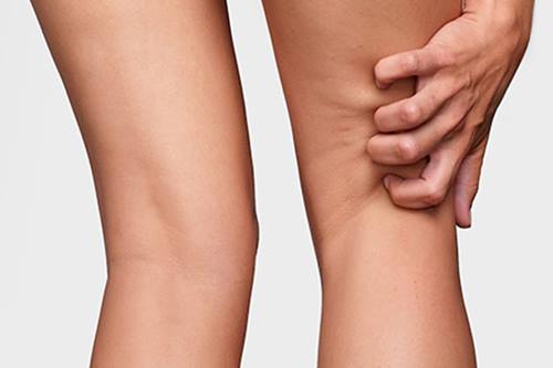 CeraVe-Itchy-Bosy-Skin