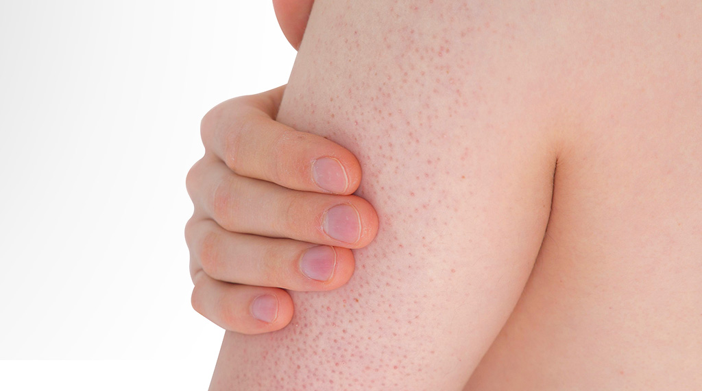 Rough, Dry Skin Patches: Causes, Treatment, Skin Care Routine | CeraVe Rough, Dry Skin Patches: Causes, Treatment, Skin Care Routine | CeraVe