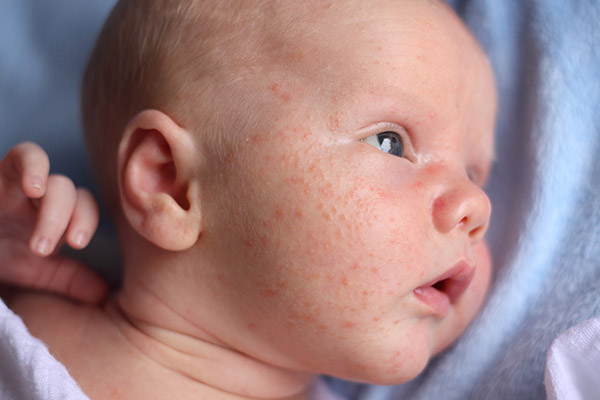 Baby's skin best sale
