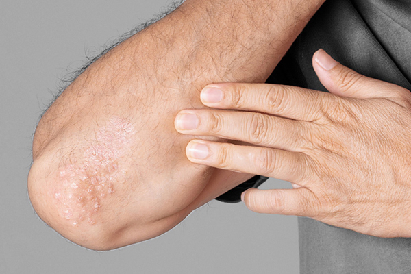 Understanding Your Skin Why is My Skin Scaly CeraVe