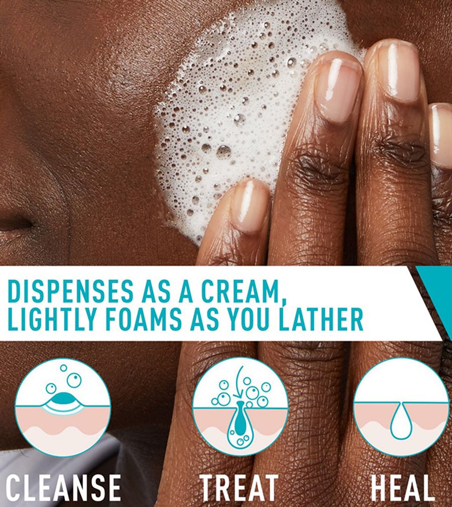  Acne Foaming Cream Cleanser thumbnail 2
