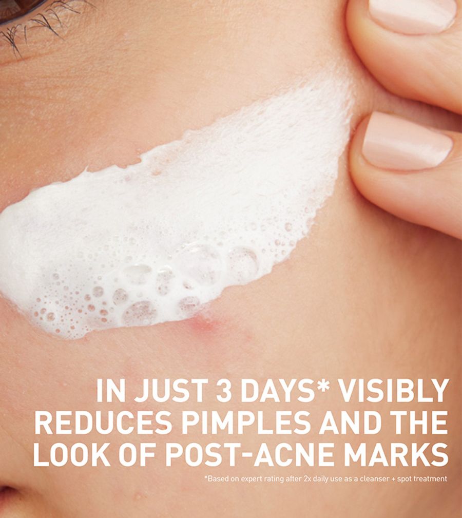 Acne Clay To Foam Cleanser thumbnail 2