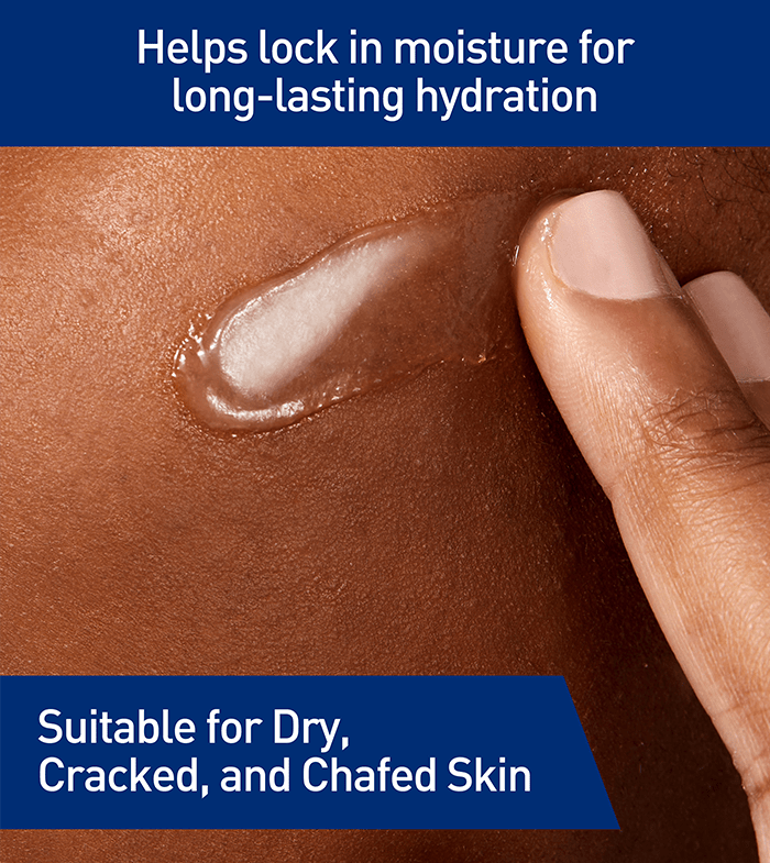 Chaffe Skin Healing Ointment for Very Dry, Chafed & Cracked Skin | CeraVe