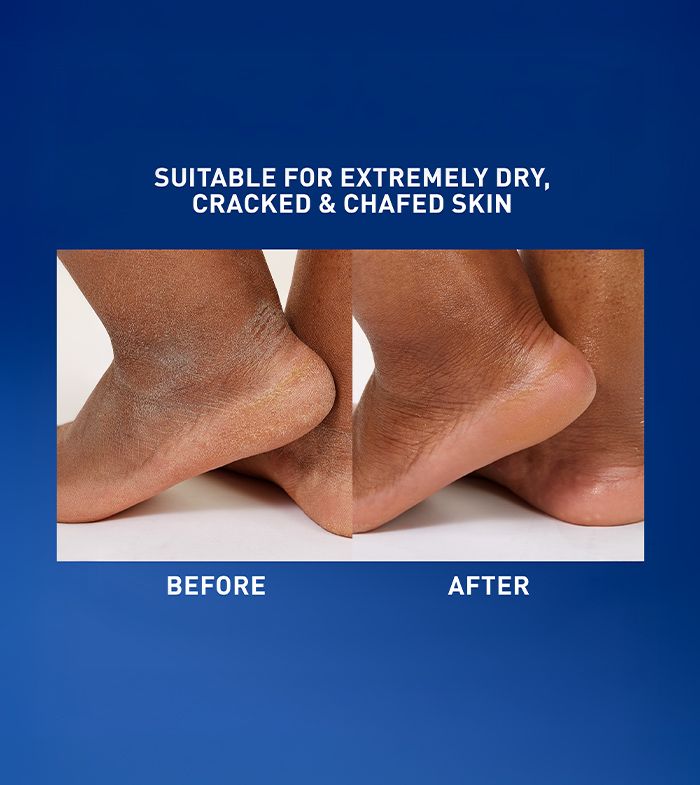 Chaffe Skin Healing Ointment for Very Dry, Chafed & Cracked Skin | CeraVe